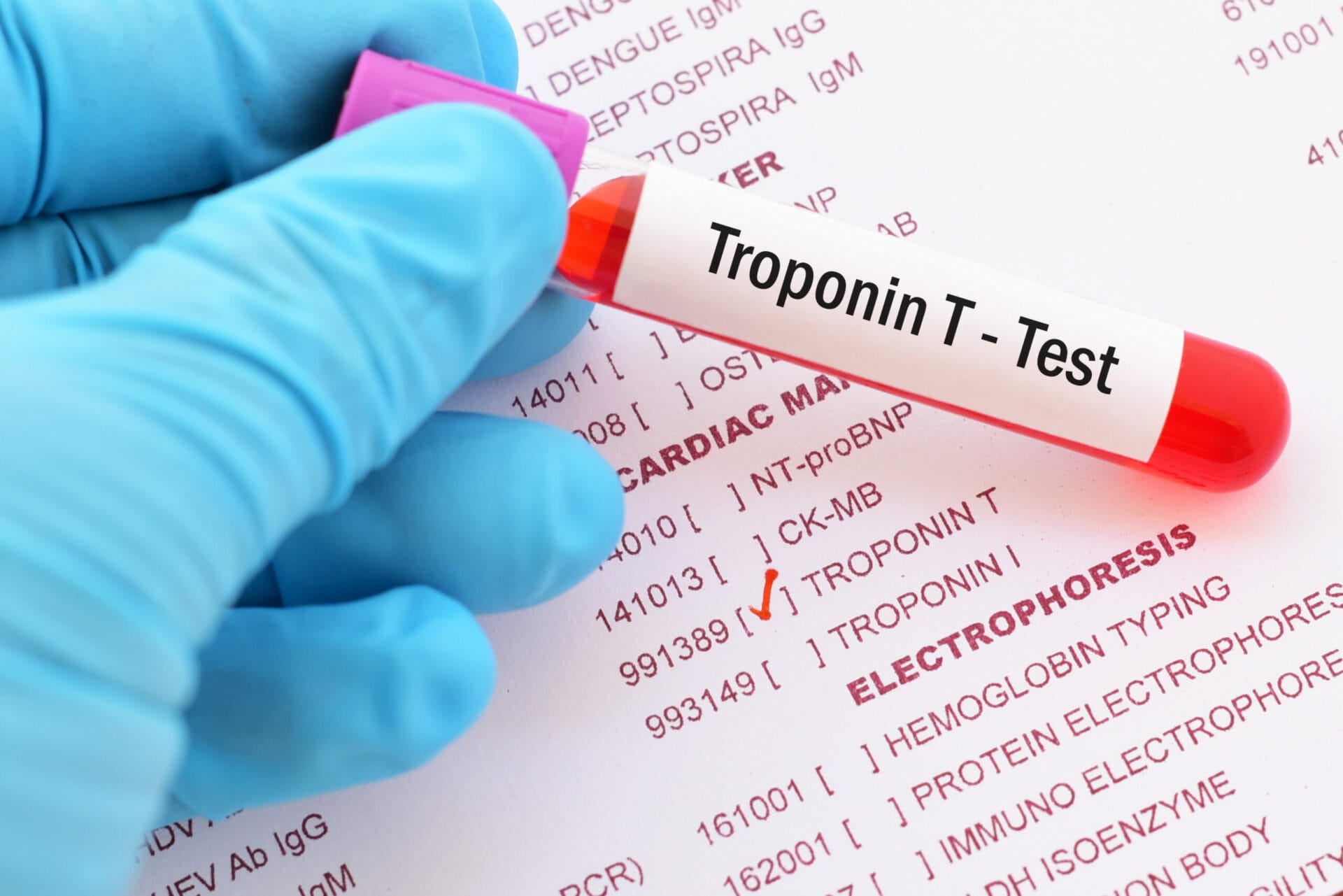 Troponin T (Qualitative) Test In Hyderabad