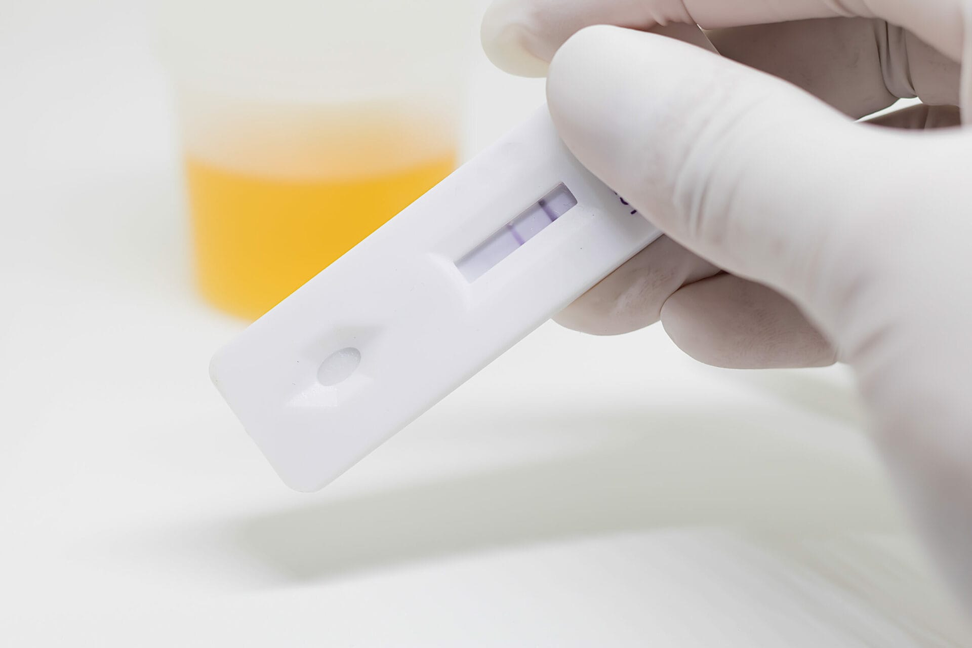 Pregnancy Test In Delhi