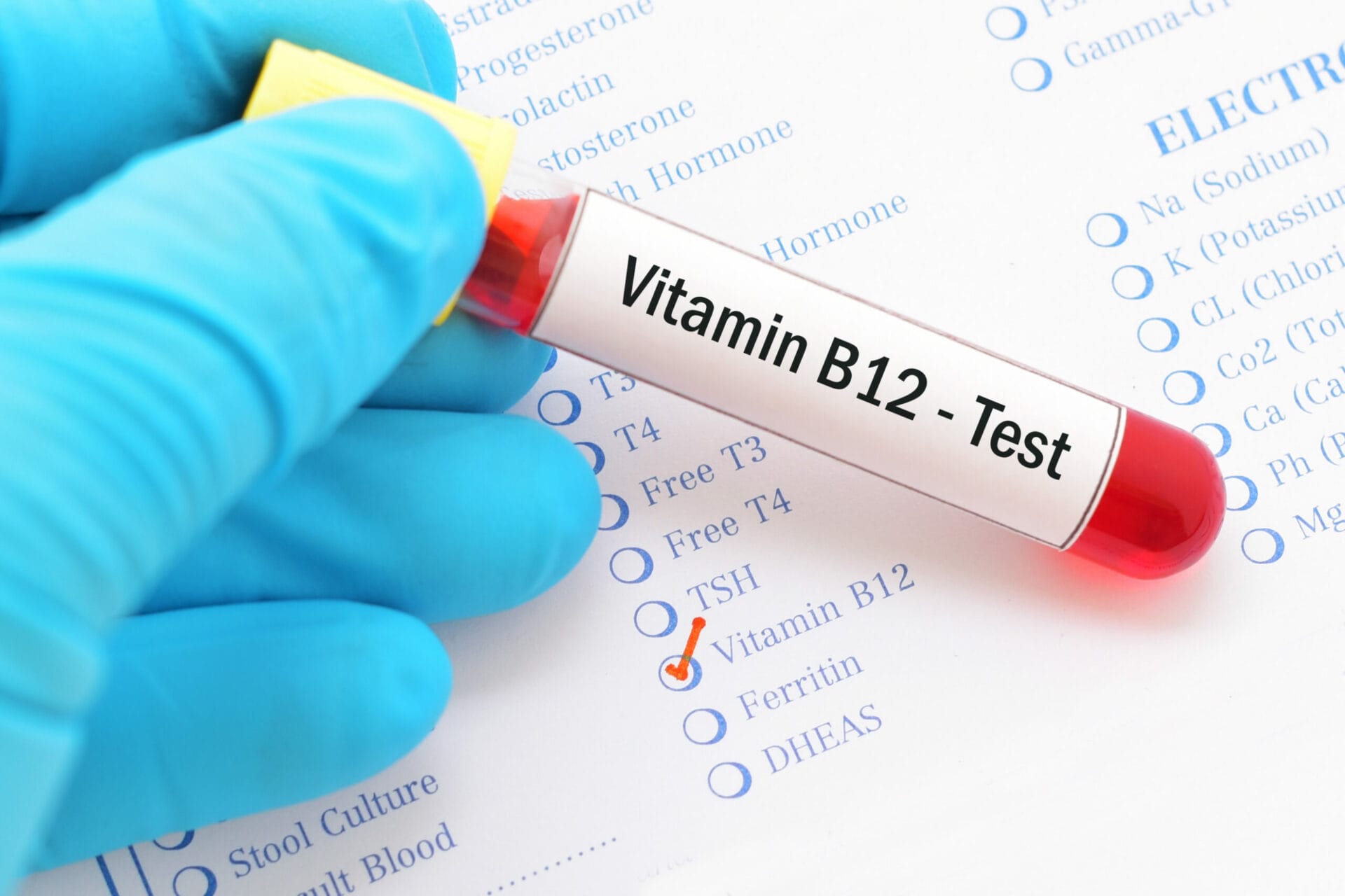 Vitamin B 12 Test In Kolkata