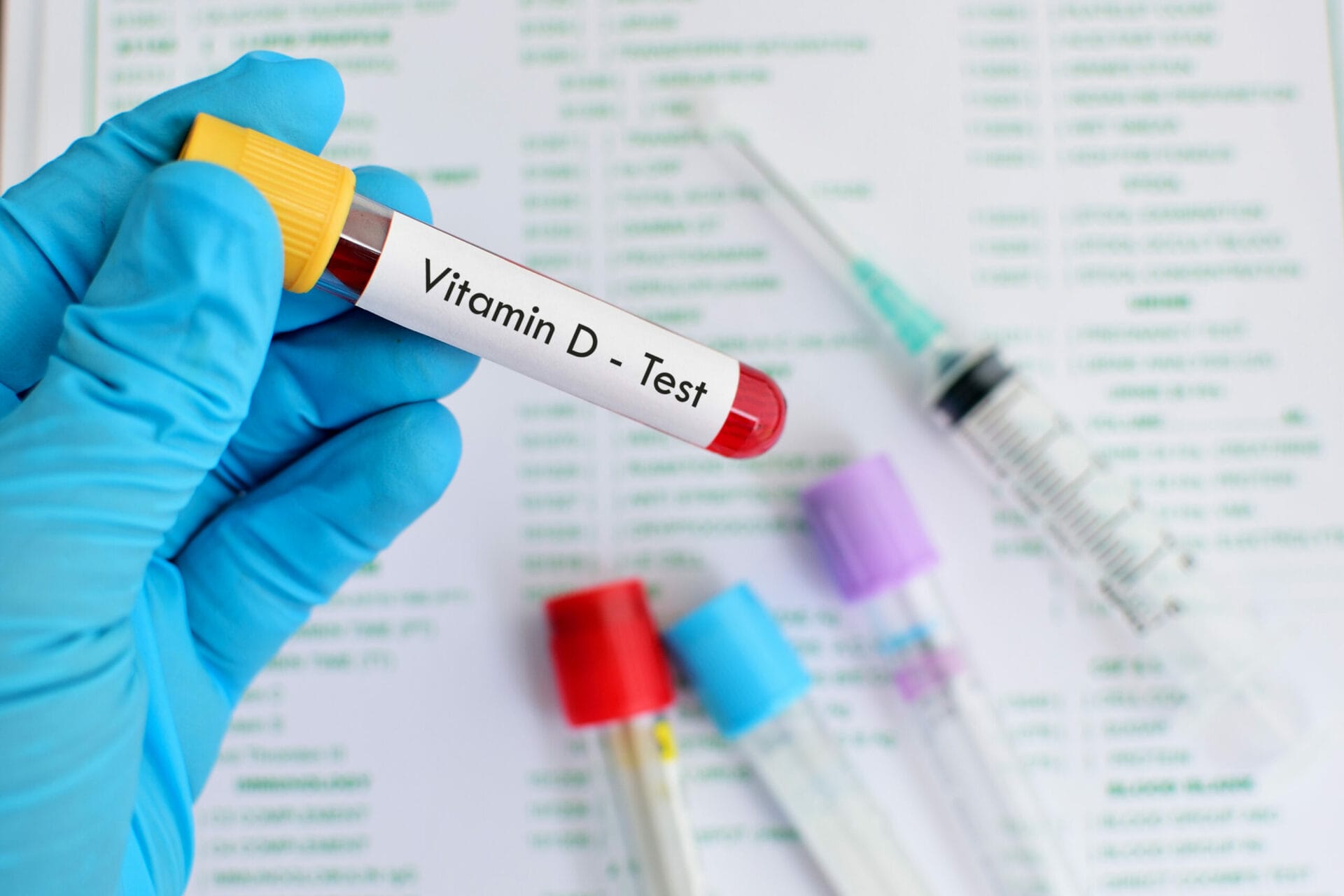 Vitamin D3 Test in Chandigarh