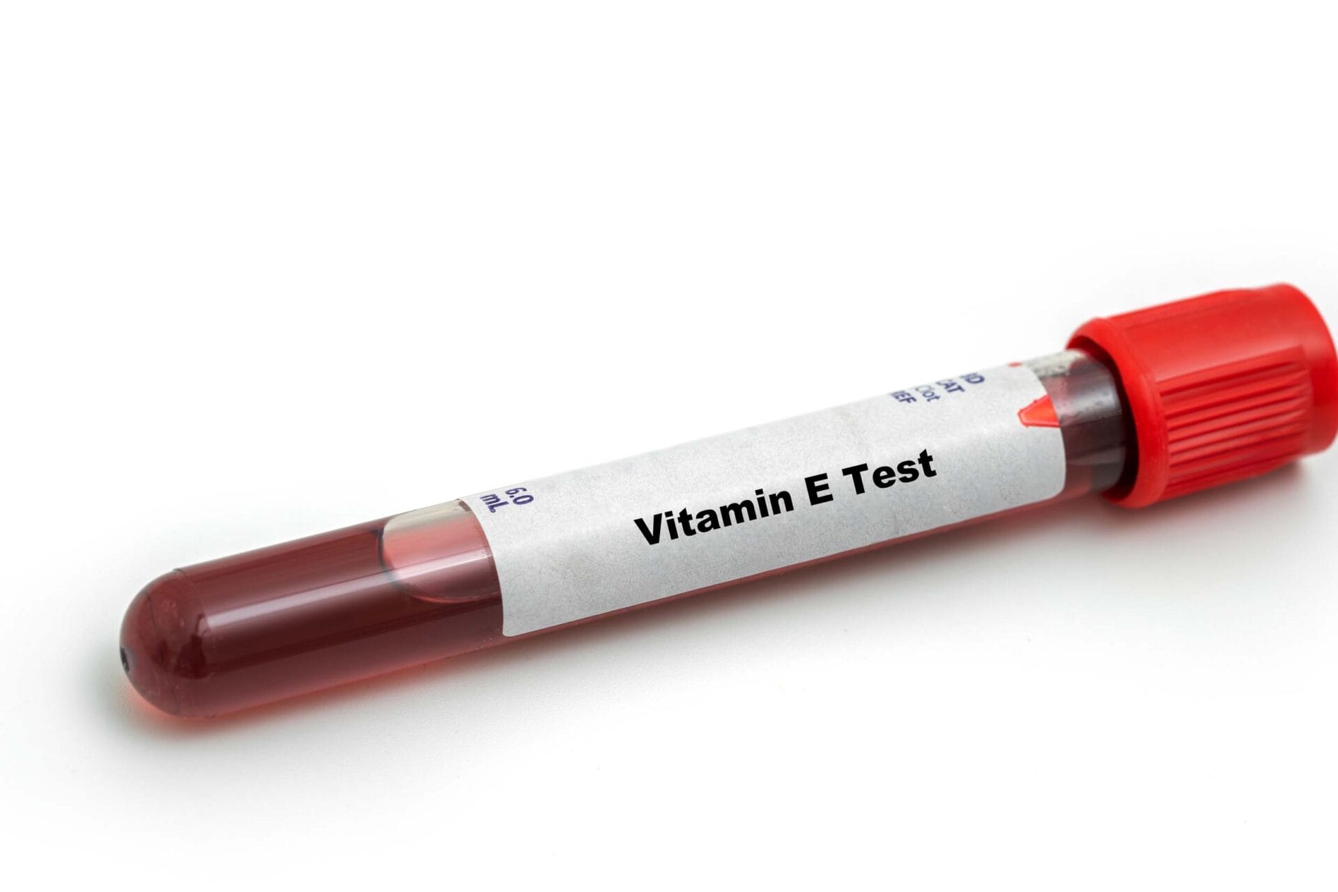Vitamin E Test In Chennai