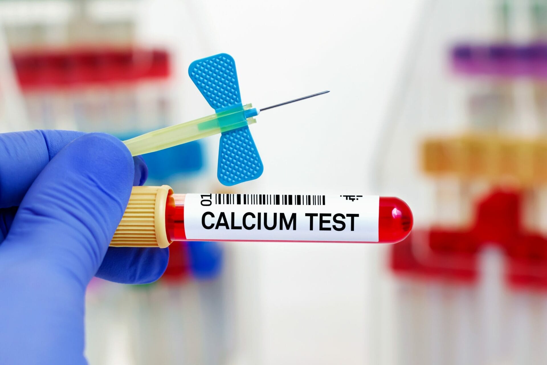 Serum Calcium Test In Chandigarh