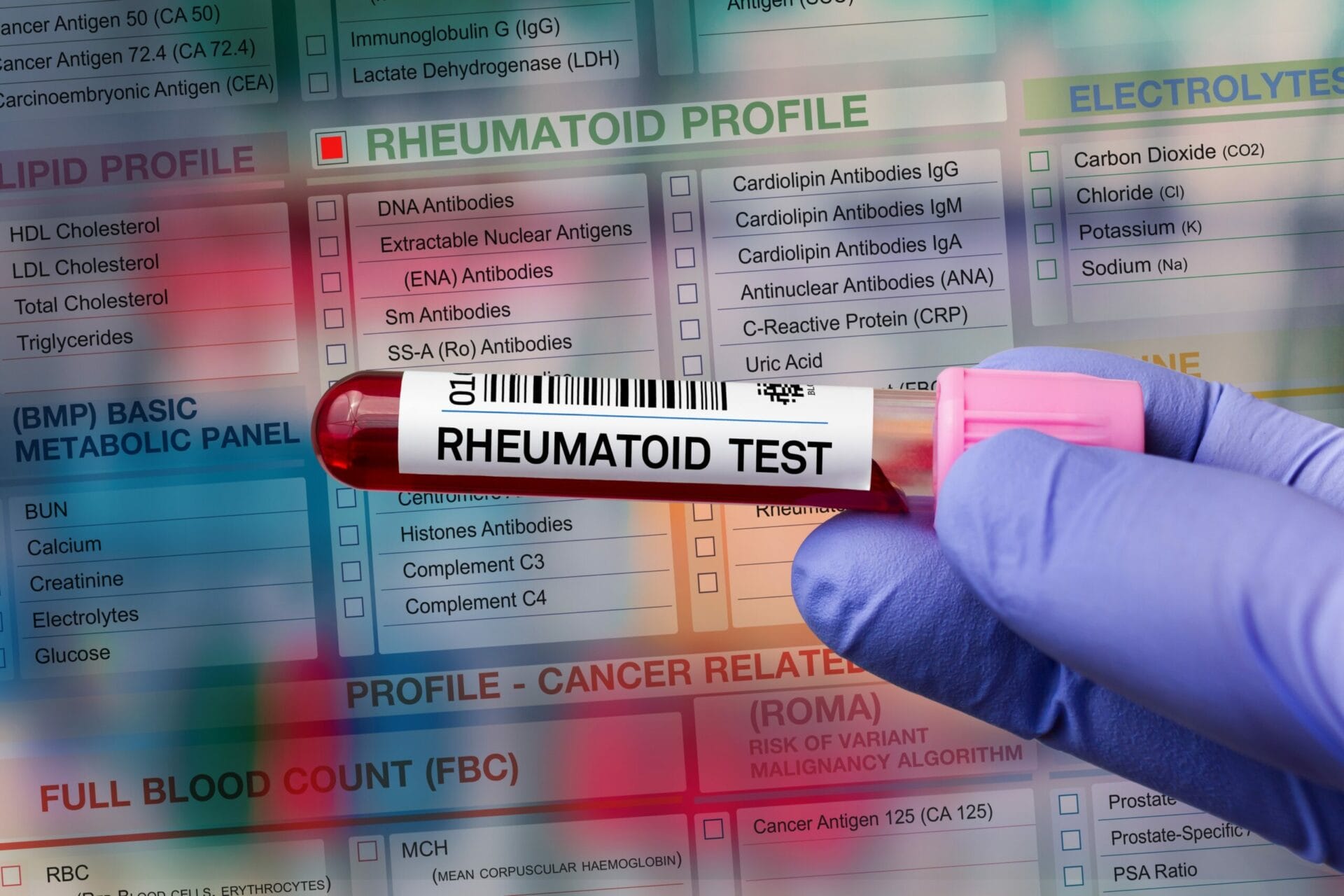 Rheumatoid Factor Test In Faridabad