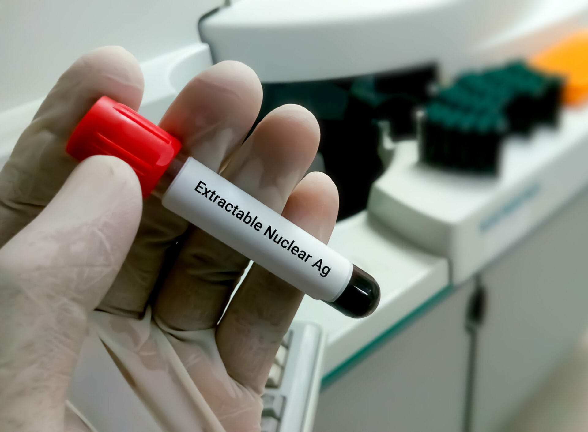 Extractable Nuclear Antigens Test In Faridabad